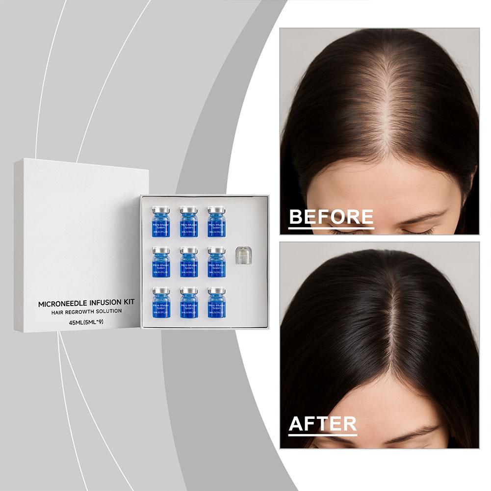 Hair Care Conditioner - 0.25mm Hair Essential Serum Micro-needle Roller