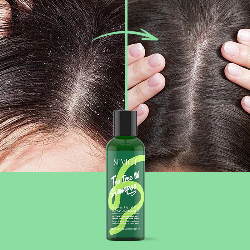 Tea Tree Essence Shampoo Hair  - Hair Care Conditioner review and price
