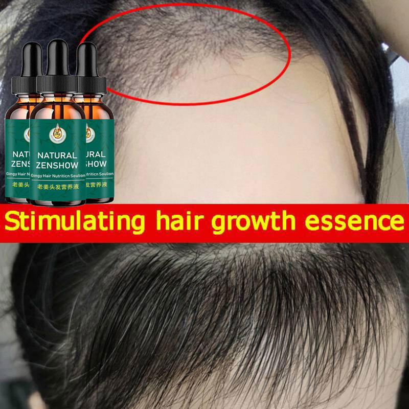 Ginger Hair Growth Essential O - Hair Care Herbal Products review and price