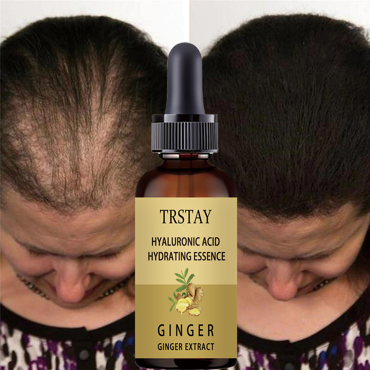 Hair Growth Serum Anti Prevent - Hair Care Gisou review and price