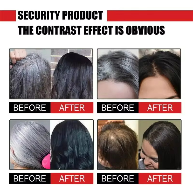 Herbal Anti-grey Hair Treatmen - Hair Care Herbal Products review and price