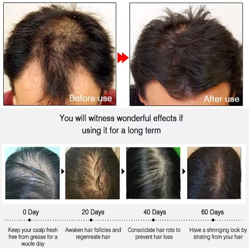 Fast Ginger Hair Growth Spray  - Hair Care For Hair Growth review and price
